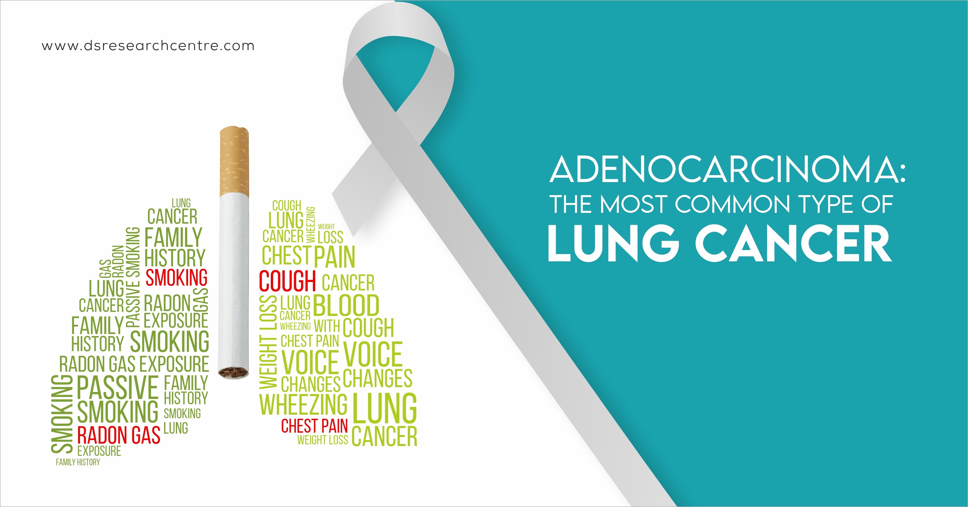 Adenocarcinome : the most common type of lung cancer